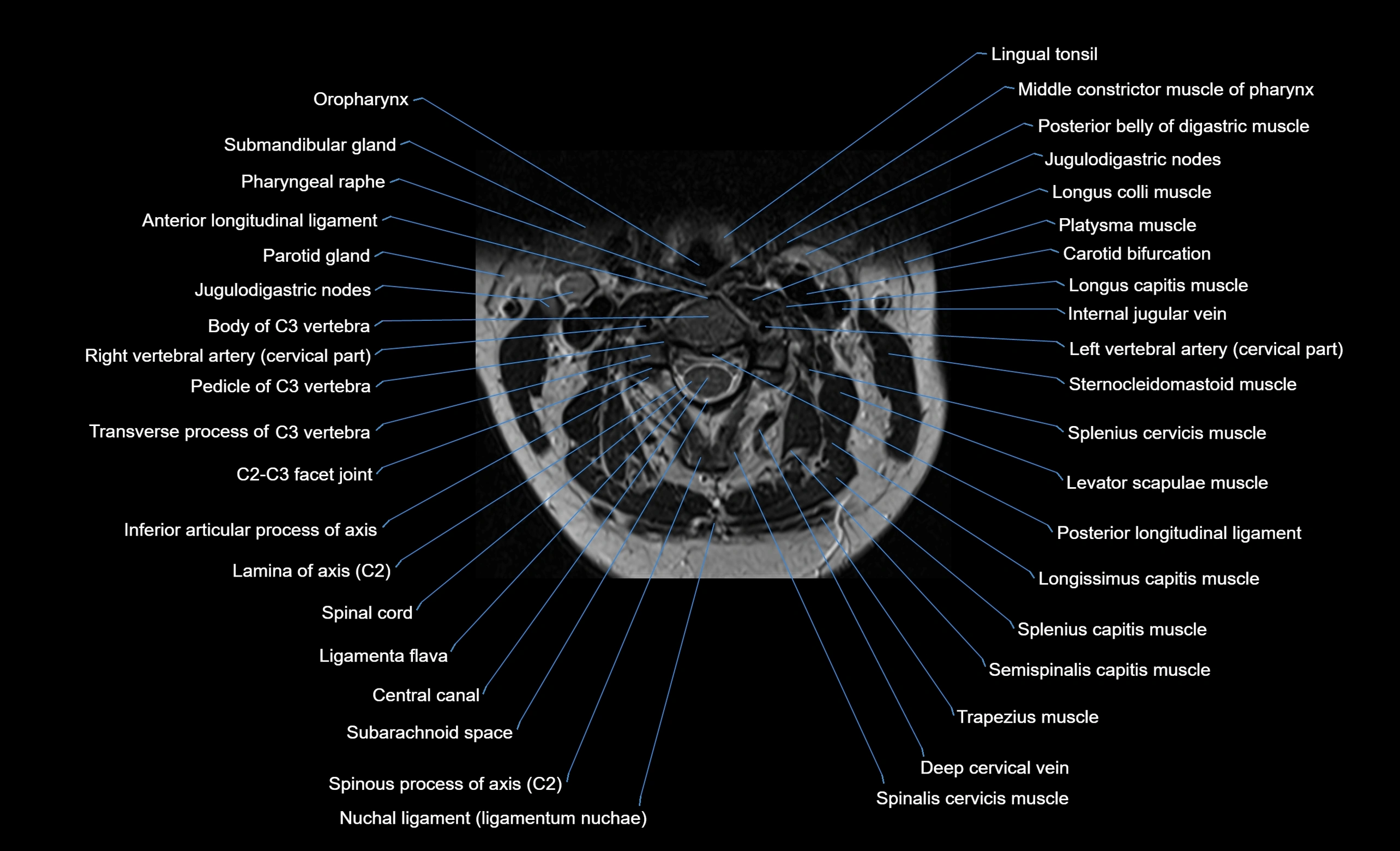 cervical spine cross sectional MRI anatomy  3T MRI axial  image-img-00001-00016.webp